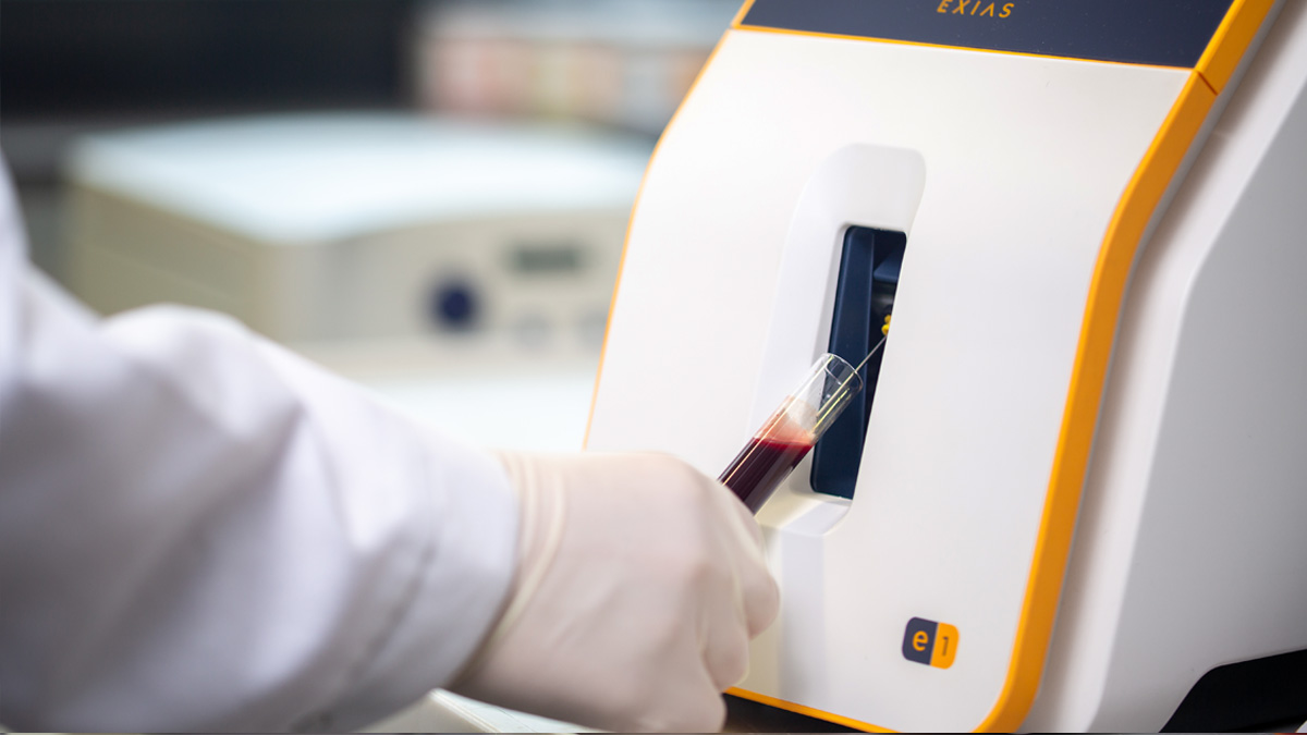 Hand med handskar som sätter in ett blodprovsrör i en laboratorieanalysator.