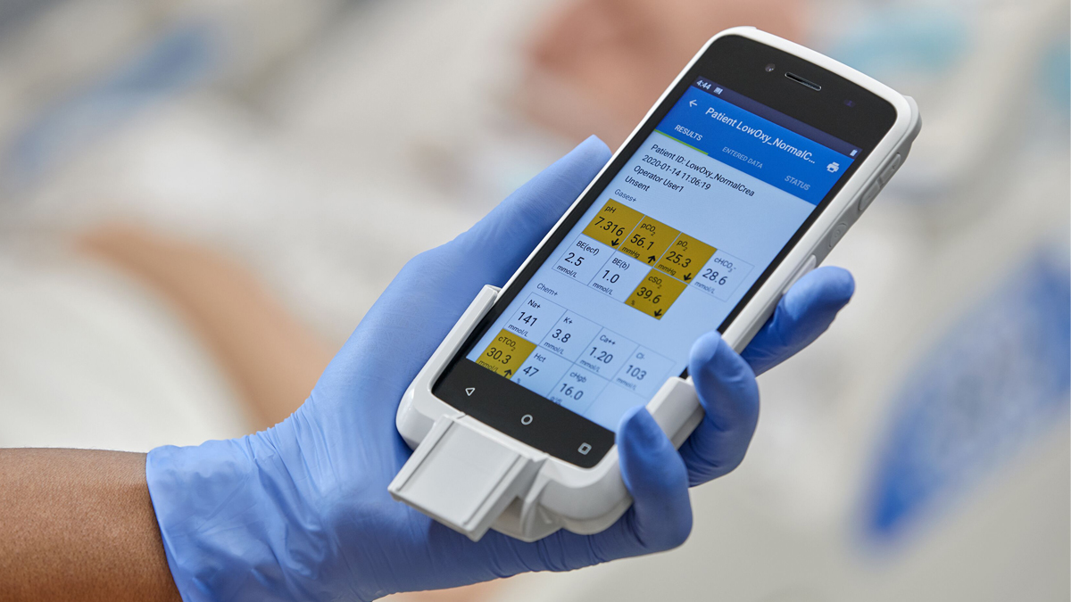 En hand med blå handske håller en medicinsk enhet som visar patientdata på en skärm.