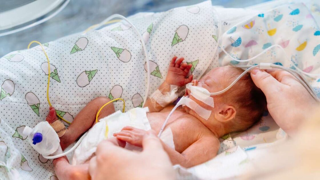 För tidigt född bebis i kuvös som sover och får vård